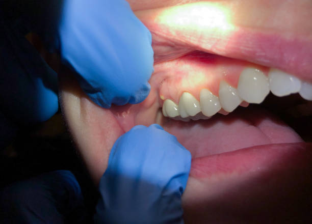 Best Broken or Cracked Tooth Emergency Dentist in Pine Bluffs, WY