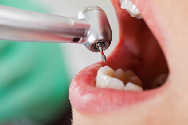 Best Orthodontic Emergency Dentist in Pine Bluffs, WY